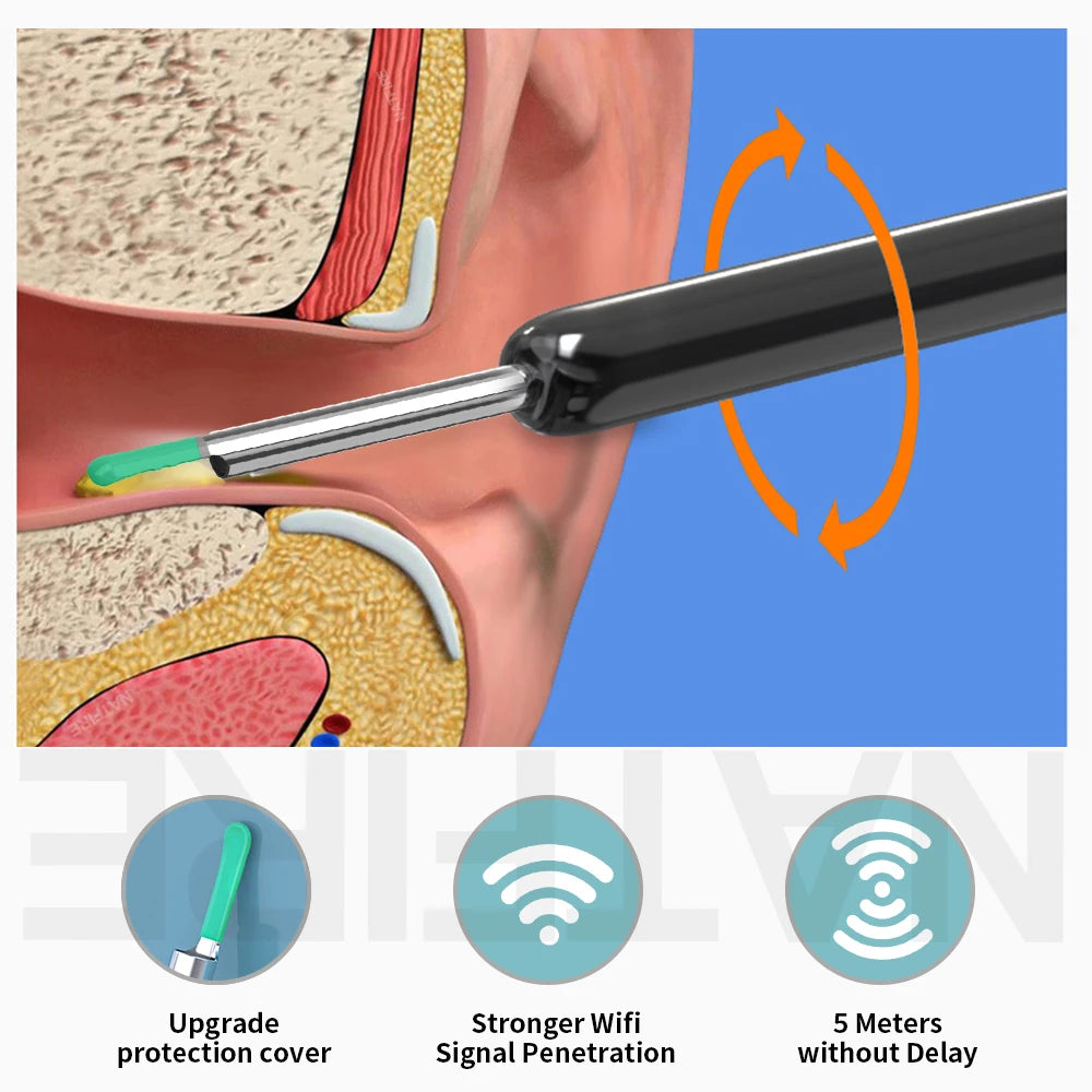 Smart Visual Ear Cleaner HD